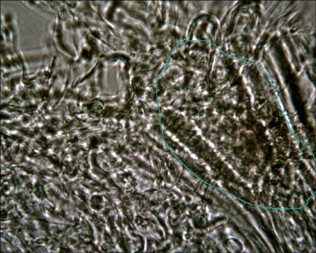Trechispora mollusca ? (Trechispora mollusca)